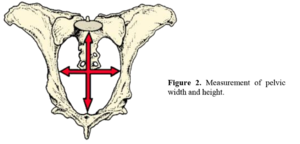 Pelvicpic.png